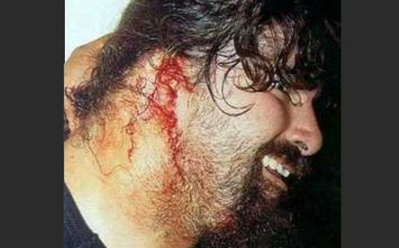 8 Insanely Real Moments in Pro Wresting - 6