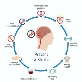 8 Important Facts You Need to Know About Stroke - 8List.ph